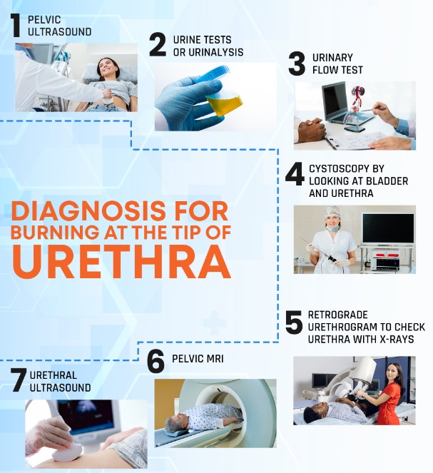 burning tip of urethra no std