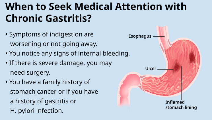 chronic gastritis