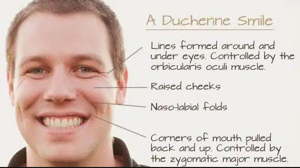 duchenne smile