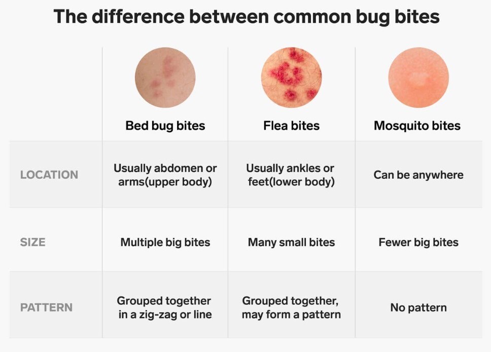 flea bites