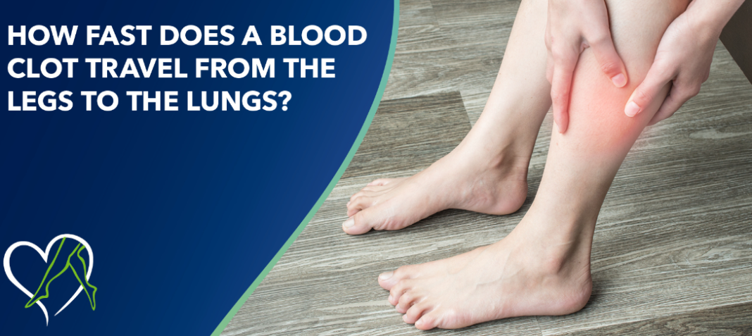 how fast does a blood clot travel from the leg to the lungs