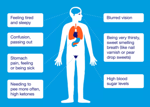 how long does it take to die from diabetic ketoacidosis