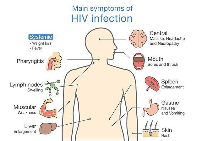 how to identify hiv rash pictures