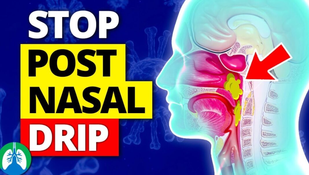 how to stop post nasal drip