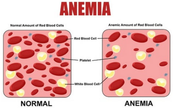 mch blood test