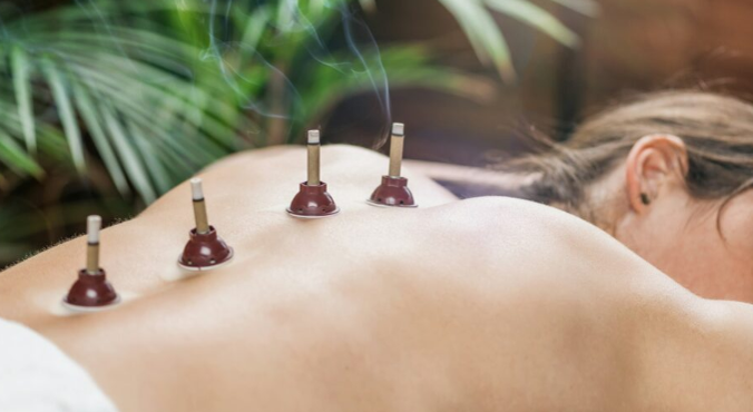 moxibustion