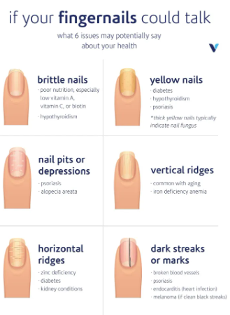 normal black line on nail vs melanoma