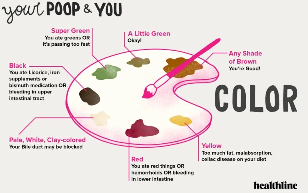 poop color chart