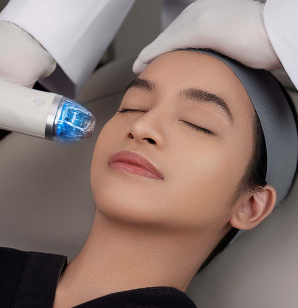 rf microneedling