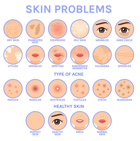 skin condition