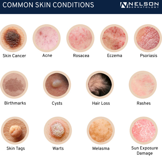 skin conditions