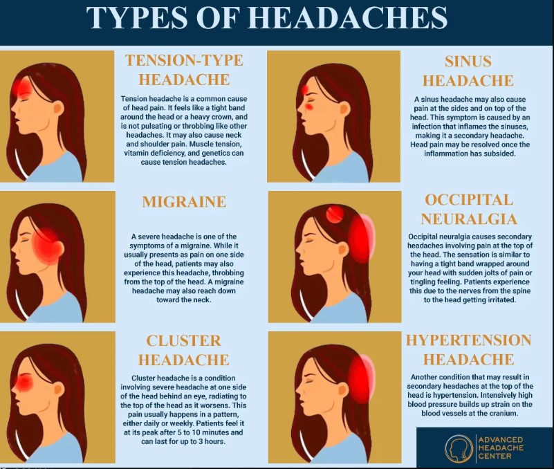 types of headaches