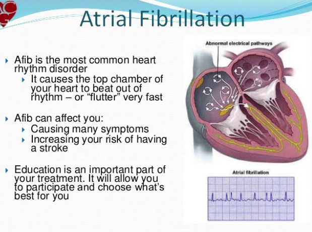 what is a dangerous heart rate with afib