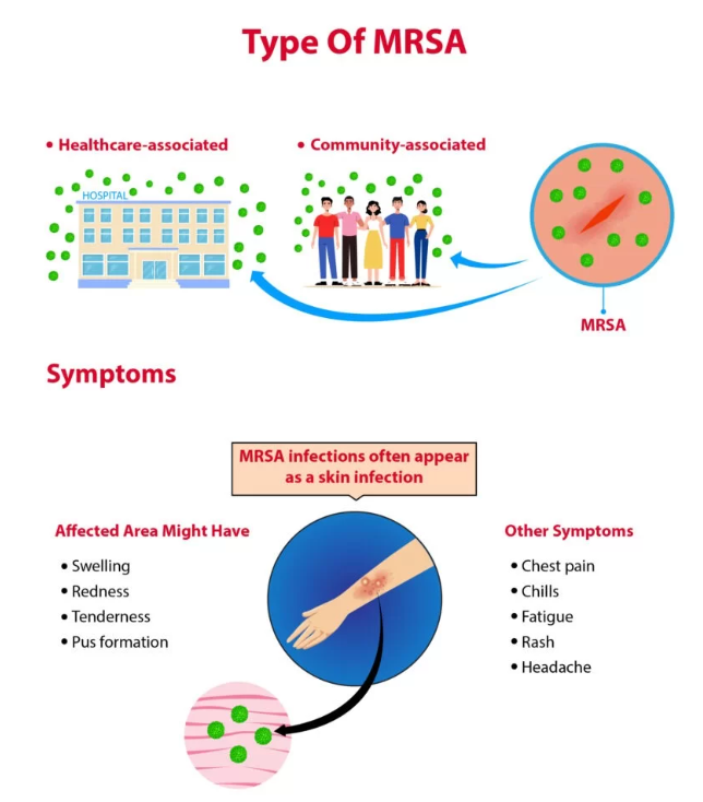 mrsa