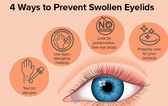 what is the fastest way to heal a swollen eyelid